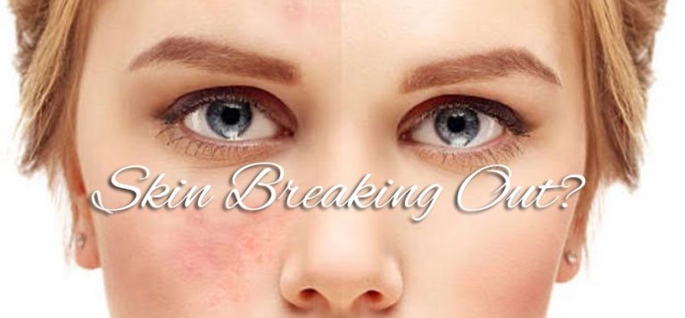 Skin Breaking Out? - the IV health centre