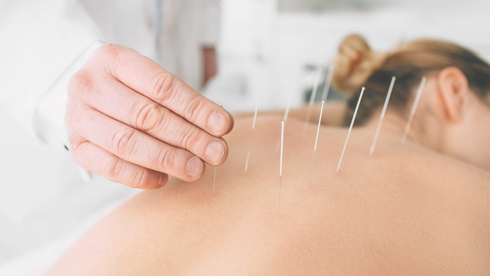 Treating Energy Flow with Acupuncture