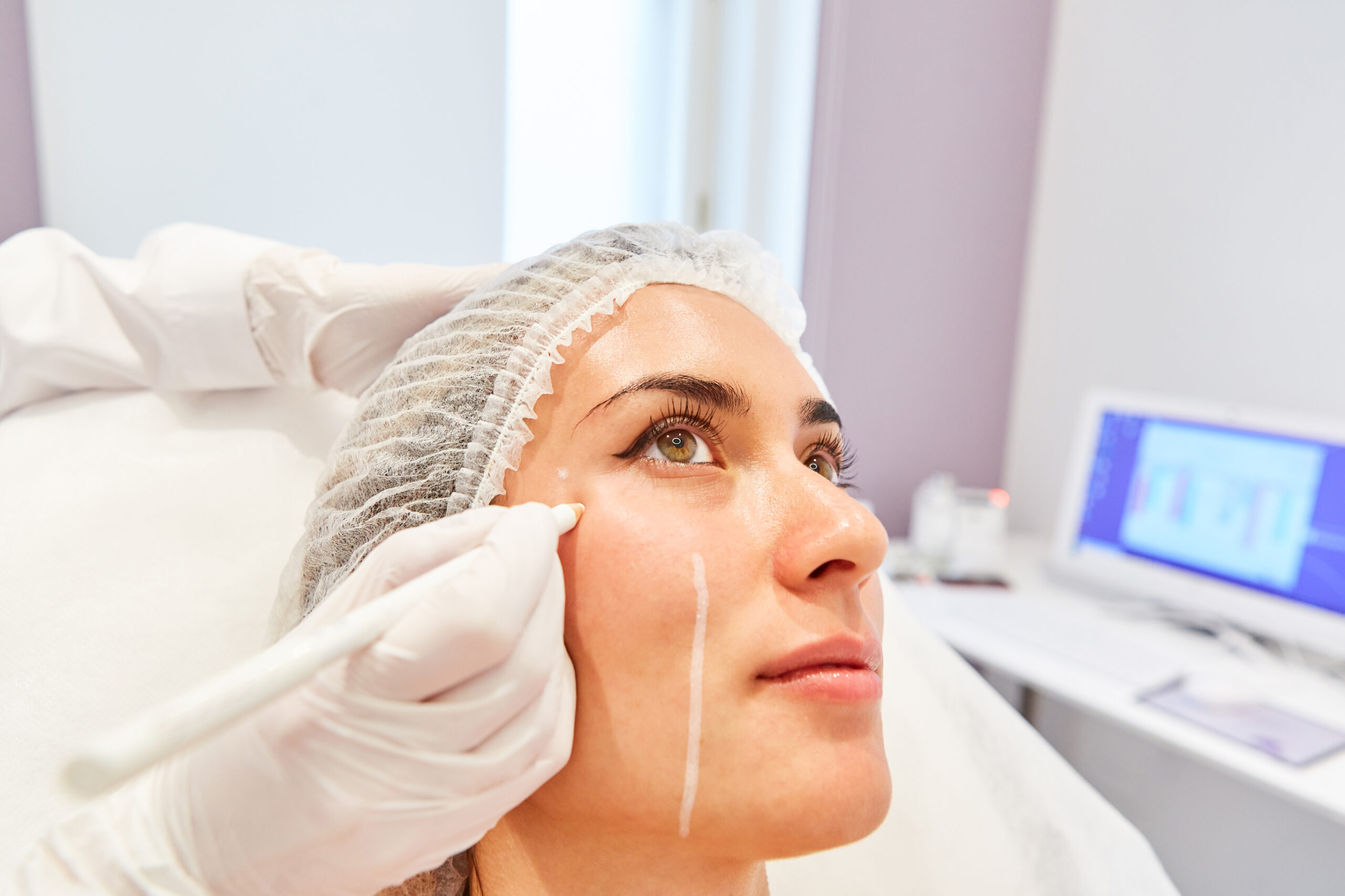 Achieving Your Aesthetic Goals with Hyaluronic Acid Fillers