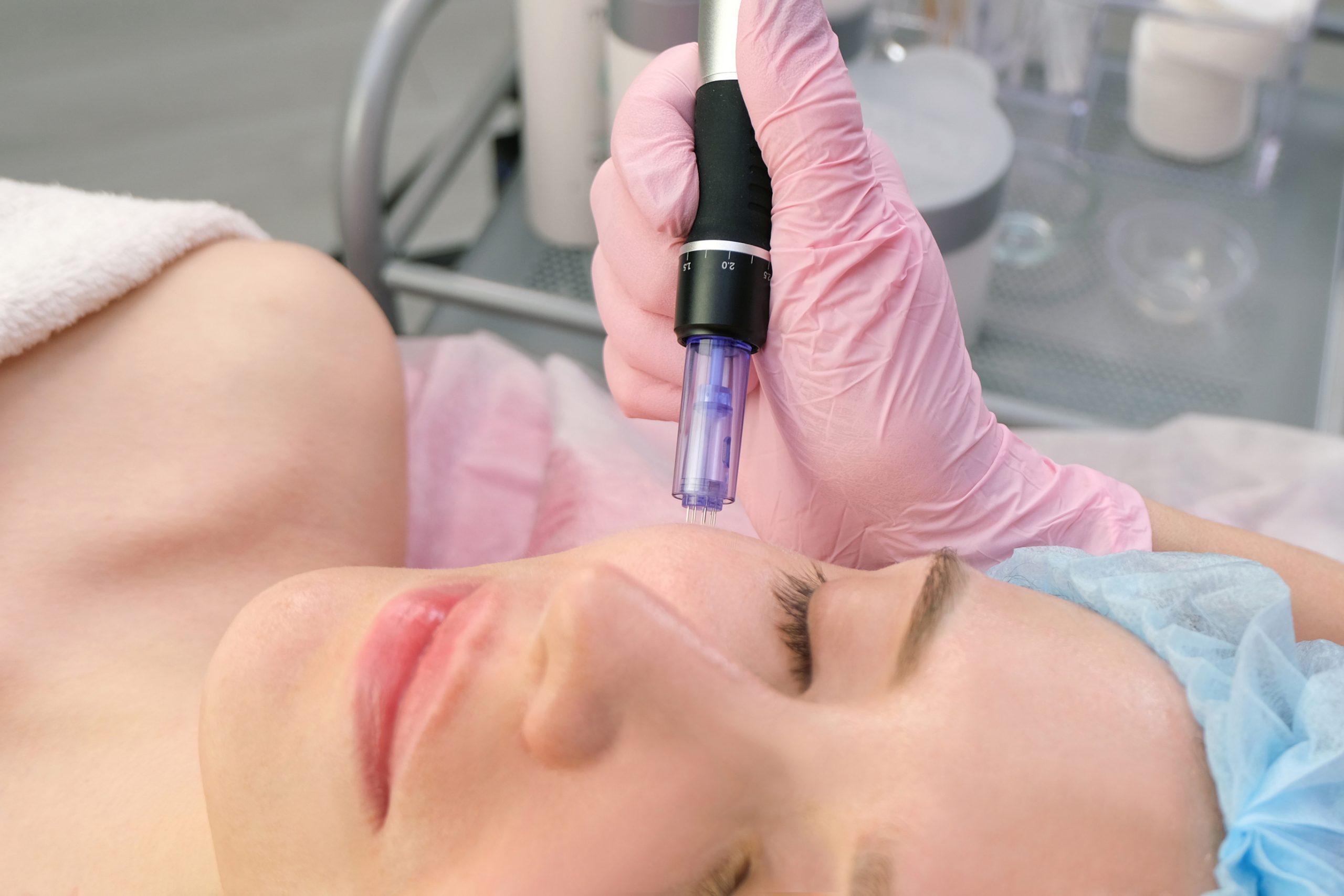 Prolong Your Summer Glow: The Power of Microneedling with Purasomes